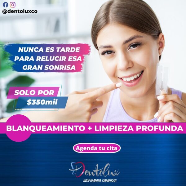 Blanqueamiento - Imagen 2